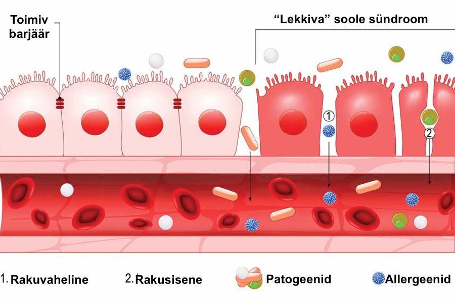 Lekkiva soole sündroomi diagramm